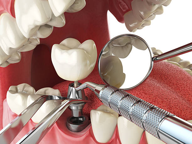 Best Cracked Tooth Emergency Dentist  in Norman, OK